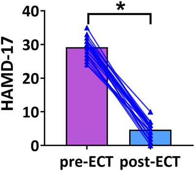 Electroconvulsive Therapy-Induced Changes in Functional Brain Network of Major Depressive Disorder Patients: A Longitudinal Resting-State Electroencephalography Study